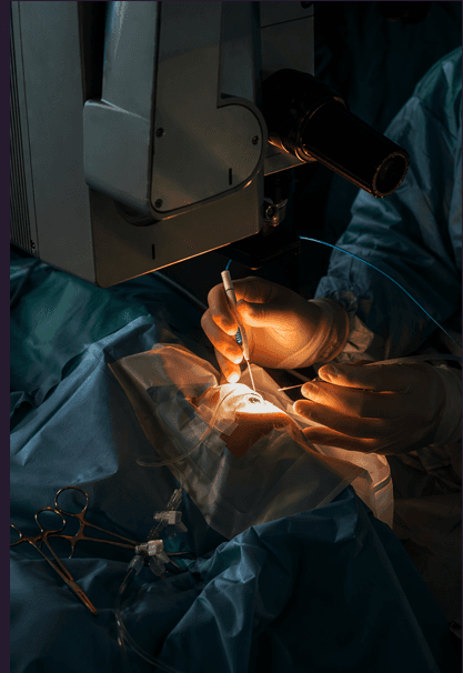 Laser surgery under microscope